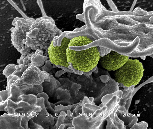 A Novel Way to Treat Multidrug-Resistant Diseases
